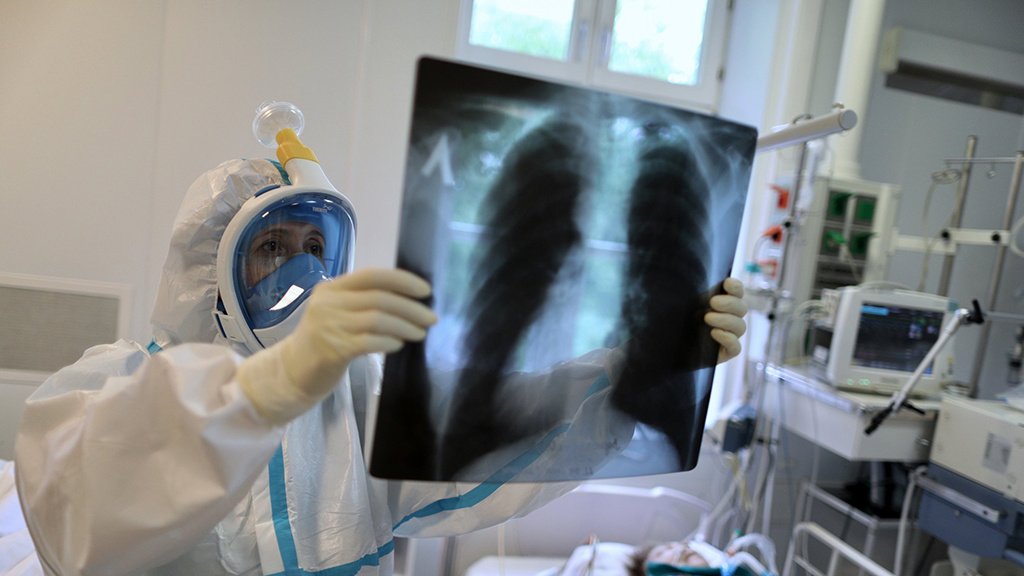 Mikhail Murashko, the Minister of Healthcare of the Russian Federation, said that covid lung damage has begun to develop approximately twice as fast