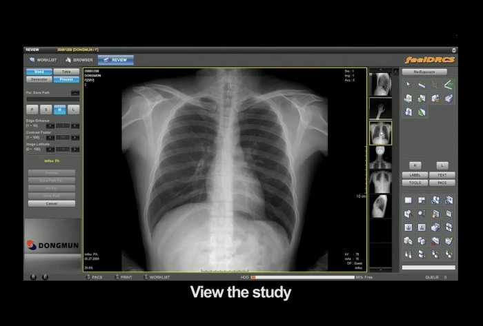 Новый способ измерения защиты от рентгеновского излучения