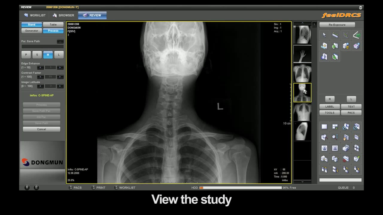 Новый способ измерения защиты от рентгеновского излучения