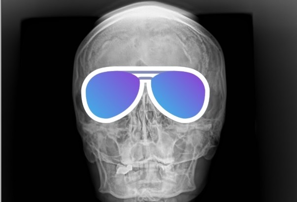 COVID-19: взгляд рентгенолога